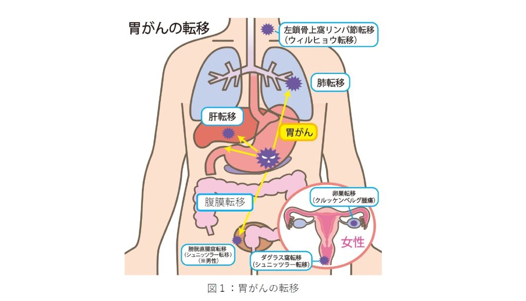 消化器外科の主な疾患画像１