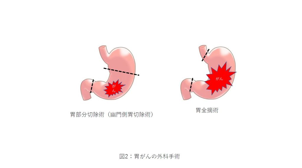 消化器外科の主な疾患画像２