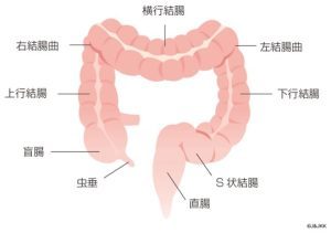 消化器外科 主な疾患（大腸がん）画像