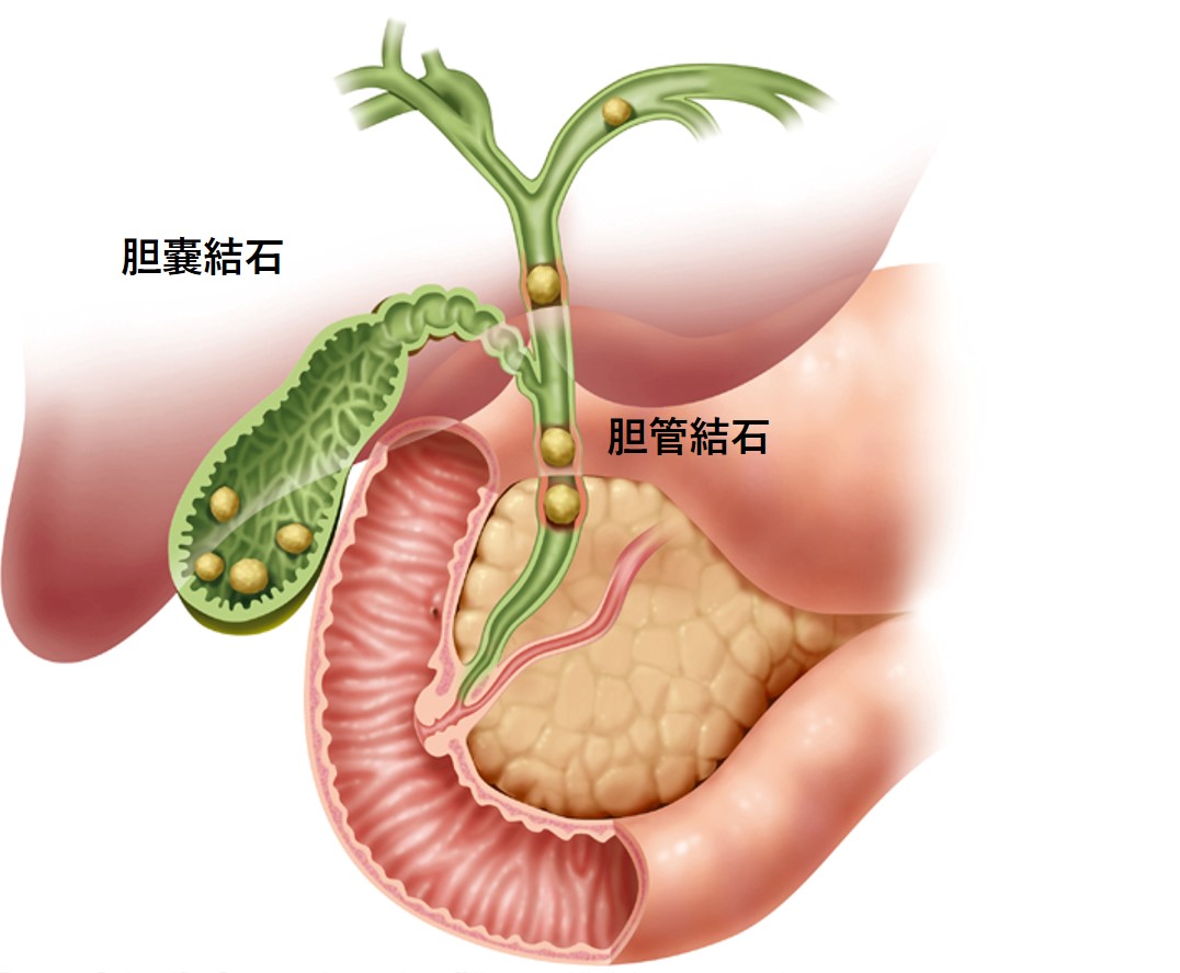 消化器外科の主な疾患画像